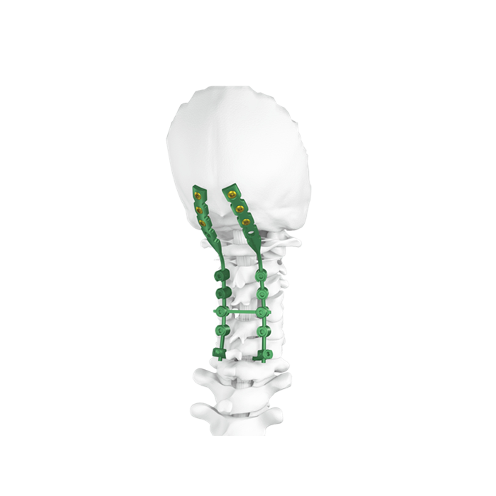 Occipito-Cervico-Thoracic (OCT) Spine System