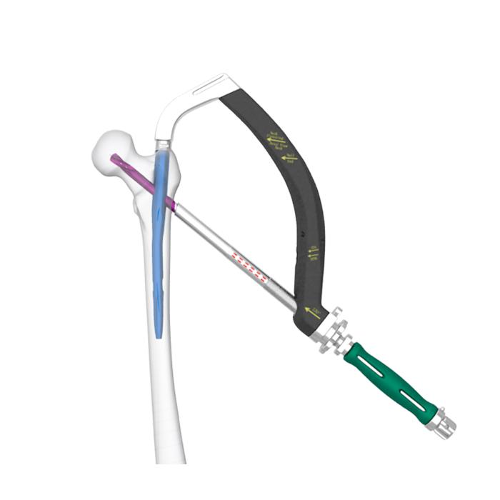 TEN-ADVANCED Proximal Femoral Nailing System