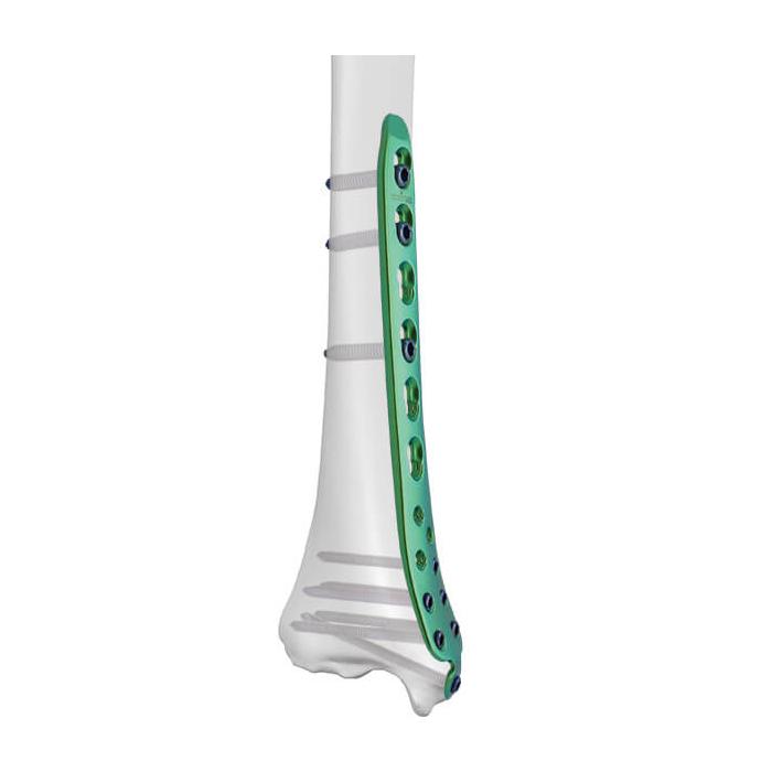 3.5mm LCP® Medial Distal Tibia Plate