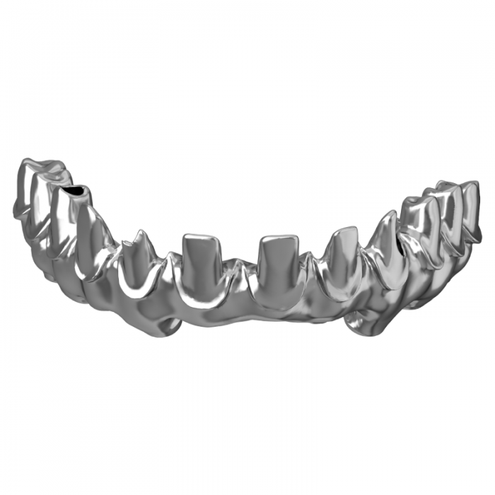 Dental Implant System