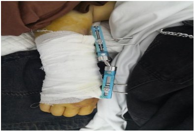 카테고리 어떻게 도와드릴까요? 고객님께 편리한 방법으로 연락해 주세요. 이메일이나 전화를 통해 24시간 연중무휴로 상담 가능합니다. 문의하기 신제품